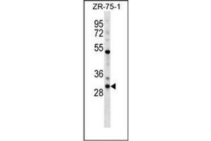 Western blot analysis of HOXD1 / HOX4G Antibody (N-term) in ZR-75-1 cell line lysates (35ug/lane).