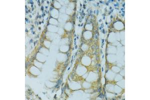 Immunohistochemistry of paraffin-embedded human colon using CYP2B6 antibody (ABIN5997556) at dilution of 1/100 (40x lens). (CYP2B6 抗体)