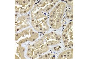Immunohistochemistry of paraffin-embedded human kidney using ACTL6B antibody at dilution of 1:100 (x400 lens). (Actin-Like 6B 抗体)