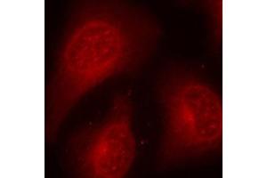 Immunofluorescence (IF) image for anti-Histone Deacetylase 8 (HDAC8) (pSer39) antibody (ABIN1870227) (HDAC8 抗体  (pSer39))
