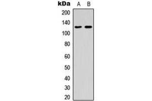 Western blot analysis of ST5 expression in K562 (A), human spleen (B) whole cell lysates.
