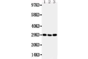 Anti-CD134/OX40 antibody,  Western blotting Lane 1: Mouse Brain Tissue Lysate Lane 2: Mouse Spleen Tissue Lysate Lane 3: Mouse Liver Tissue Lysate