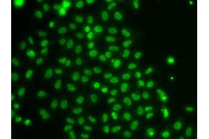 Immunofluorescence analysis of U20S cell using TOX antibody. (TOX 抗体)