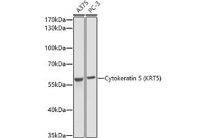 Western blot analysis of extracts of various cell lines, using Cytokeratin 5 (KRT5) antibody (ABIN3016404, ABIN3016405, ABIN3016406 and ABIN6219743) at 1:1000 dilution. (Cytokeratin 5 抗体)