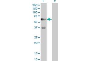 Western Blot analysis of PFKFB3 expression in transfected 293T cell line by PFKFB3 monoclonal antibody (M08), clone 3F3. (PFKFB3 抗体  (AA 412-520))