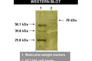 Western Blotting (WB) image for anti-RYK Receptor-Like Tyrosine Kinase (RYK) antibody (ABIN264516) (RYK 抗体)