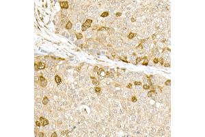 Immunohistochemistry of paraffin-embedded rat liver using CD81 Rabbit pAb (ABIN6134776, ABIN6138231, ABIN6138232 and ABIN6220897) at dilution of 1:50 (40x lens). (CD81 抗体  (AA 1-100))