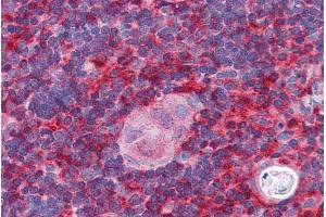 Immunohistochemistry (IHC) image for anti-Actin Related Protein 2/3 Complex, Subunit 1B, 41kDa (ARPC1B) (N-Term) antibody (ABIN184750)