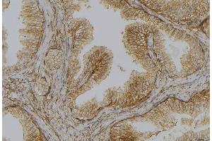ABIN6278110 at 1/100 staining Mouse colon tissue by IHC-P. (DAP Kinase 1 抗体  (Internal Region))
