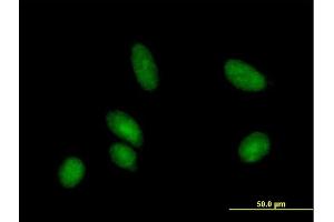 Immunofluorescence of purified MaxPab antibody to CDA on HeLa cell. (CDA 抗体  (AA 1-146))