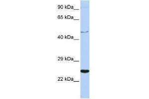 WB Suggested Anti-CRLF1 Antibody Titration:  0. (CRLF1 抗体  (Middle Region))