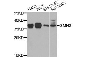 Western blot analysis of extracts of various cell lines, using SMN2 Antibody (ABIN5974442) at 1/1000 dilution. (SMN2 抗体)