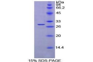 SDS-PAGE (SDS) image for Protein tyrosine Phosphatase, Receptor Type, S (PTPRS) protein (ABIN3011382)