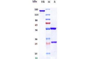 Anti-TNFRSF8 / CD30 Reference Antibody (brentuximab) on SDS-PAGE under reducing (R) condition. (Recombinant TNFRSF8 (Brentuximab Biosimilar) 抗体)