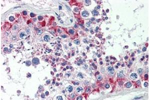Human Testis (formalin-fixed, paraffin-embedded) stained with MAS1 antibody ABIN462250 followed by biotinylated goat anti-rabbit IgG secondary antibody ABIN481713, alkaline phosphatase-streptavidin and chromogen. (MAS1 抗体  (AA 187-236))