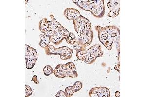 anti-Cysteinyl-tRNA Synthetase (CARS) (AA 510-748) antibody