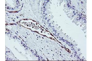 Image no. 2 for anti-Dystrobrevin, beta (DTNB) antibody (ABIN1497914) (Dystrobrevin beta 抗体)