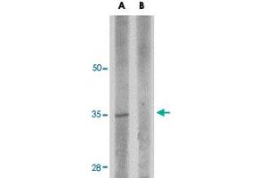 Western blot analysis of RWDD3 in rat kidney tissue lysate with RWDD3 polyclonal antibody  at 1 ug/mL in (A) the absence and (B) the presence of blocking peptide. (RWDD3 抗体  (C-Term))
