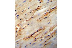 Immunohistochemistry (IHC) image for anti-Collagen, Type V, alpha 1 (COL5A1) (AA 54-82), (N-Term) antibody (ABIN5530939)