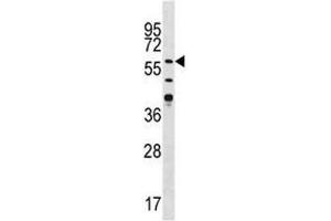 Western blot analysis of CAMK2G antibody in Jurkat lysate (CAMKII gamma 抗体  (AA 309-338))