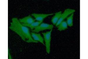 ICC/IF analysis of GSR in HeLa cells line, stained with DAPI (Blue) for nucleus staining and monoclonal anti-human GSR antibody (1:100) with goat anti-mouse IgG-Alexa fluor 488 conjugate (Green).