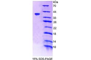 SDS-PAGE (SDS) image for Tensin 1 (TNS1) (AA 4-307) protein (His tag) (ABIN6239132)