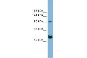 WB Suggested Anti-MAML3 Antibody Titration:  0. (MAML3 抗体  (Middle Region))