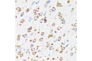 Immunohistochemistry of paraffin-embedded rat brain using K/Elp3 Rabbit mAb (ABIN1680361, ABIN3015008, ABIN3015009 and ABIN7101302) at dilution of 1:100 (40x lens). (ELP3/KAT9 抗体)