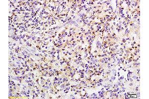 Formalin-fixed and paraffin embedded rat small intestine labeled with Anti phospho-PRKCB(Ser642) Polyclonal Antibody, Unconjugated (ABIN711461) at 1:200 followed by conjugation to the secondary antibody and DAB staining (Pkc beta 1 抗体  (pSer642))