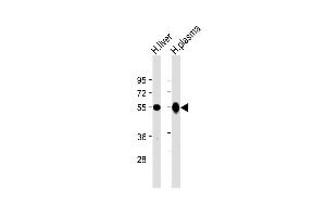 Western Blot at 1:2000 dilution Lane 1: human liver lysate Lane 2: human plasma lysate Lysates/proteins at 20 ug per lane. (Gc (AA 442-473) 抗体)