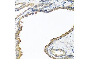 Immunohistochemistry of paraffin-embedded human prostate using NYX antibody.