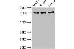 Western Blot Positive WB detected in: Mouse brain tissue, Rat heart tissue, Rat liver tissue All lanes: RPS6KA5 antibody at 3 μg/mL Secondary Goat polyclonal to rabbit IgG at 1/50000 dilution Predicted band size: 90, 62, 82 kDa Observed band size: 90 kDa (MSK1 抗体  (AA 224-367))