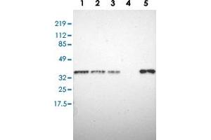Western blot analysis of Lane 1: RT-4, Lane 2: U-251 MG, Lane 3: A-431, Lane 4: Liver, Lane 5: Tonsil with STX7 polyclonal antibody  at 1:250-1:500 dilution. (Syntaxin 7 抗体)