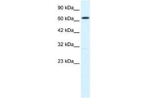 Western Blotting (WB) image for anti-Potassium Intermediate/small Conductance Calcium-Activated Channel, Subfamily N, Member 2 (KCNN2) (C-Term) antibody (ABIN2776144)