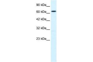 WB Suggested Anti-KCNN2 Antibody Titration:  1. (KCNN2 抗体  (C-Term))
