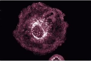 Immunofluorescence staining of Hs 766T cells (Human pancreatic carcinoma, ATCC HTB-134).