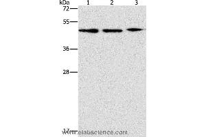 Western blot analysis of PC3, Jurkat and Raji cell, using APOBEC3G Polyclonal Antibody at dilution of 1:240 (APOBEC3G 抗体)