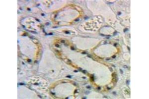 Used in DAB staining on fromalin fixed paraffin-embedded Kidney tissue (Activin A Receptor Type IB/ALK-4 抗体  (AA 24-126))
