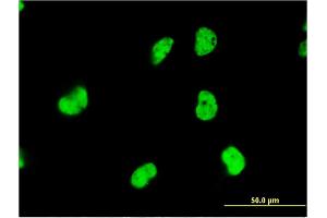 Immunofluorescence of monoclonal antibody to DAZAP1 on HeLa cell. (DAZAP1 抗体  (AA 308-407))