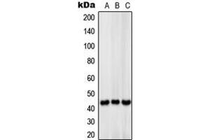 Western blot analysis of MCT13 expression in HeLa (A), mouse liver (B), rat liver (C) whole cell lysates. (SLC16A13 抗体  (C-Term))