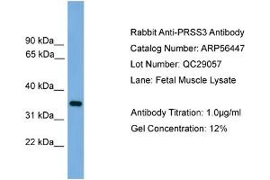 WB Suggested Anti-PRSS3  Antibody Titration: 0. (PRSS3 抗体  (N-Term))