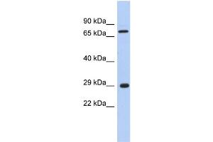WB Suggested Anti-AKTIP Antibody Titration: 0. (AKTIP 抗体  (Middle Region))