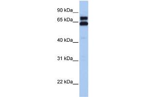 WB Suggested Anti-HSPD1 Antibody Titration:  0. (HSPD1 抗体  (C-Term))