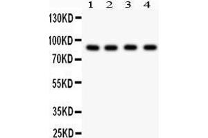 Western Blotting (WB) image for anti-Furin (Paired Basic Amino Acid Cleaving Enzyme) (FURIN) (AA 591-794) antibody (ABIN3042409) (FURIN 抗体  (AA 591-794))