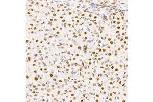Immunohistochemistry of paraffin-embedded rat ovary using TCE Rabbit mAb (ABIN7270877) at dilution of 1:25 (40x lens).