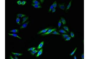 anti-Transmembrane Protein 140 (TMEM140) (AA 33-77) antibody