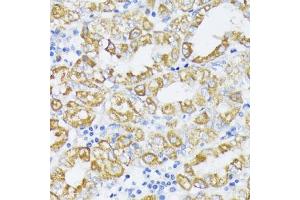 Immunohistochemistry of paraffin-embedded human stomach using SLC30 antibody (2532) at dilution of 1:100 (40x lens). (SLC30A1 抗体  (AA 250-350))
