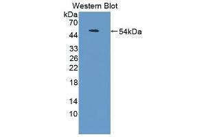 Western blot analysis of the recombinant protein. (CD58 抗体  (AA 1-214))