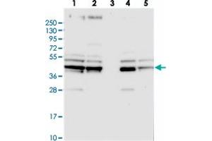 Western blot analysis of Lane 1: RT-4, Lane 2: U-251 MG, Lane 3: Human Plasma, Lane 4: Liver, Lane 5: Tonsil with SUCLA2 polyclonal antibody . (SUCLA2 抗体)