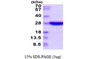 SDS-PAGE (SDS) image for Renin (REN) (AA 24-406) (Active) protein (His tag) (ABIN6387863) (Renin Protein (REN) (AA 24-406) (His tag))